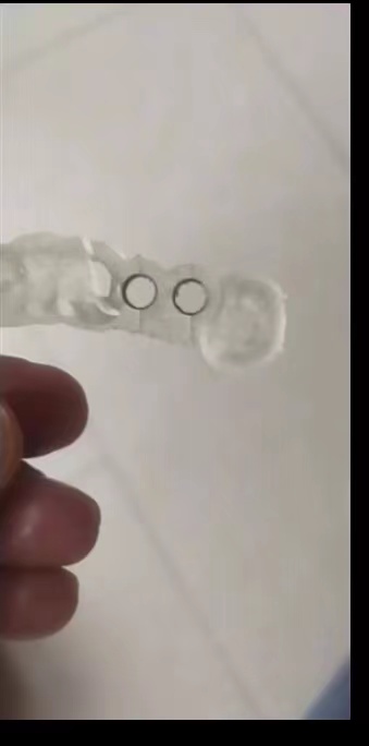 Resin Dental 3D Printer Planti - 3D Printing Guide ulasan dan harga